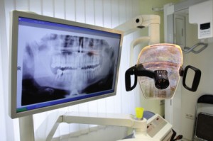 digital-x-ray