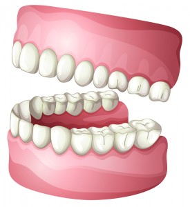 gum-tissue-graft